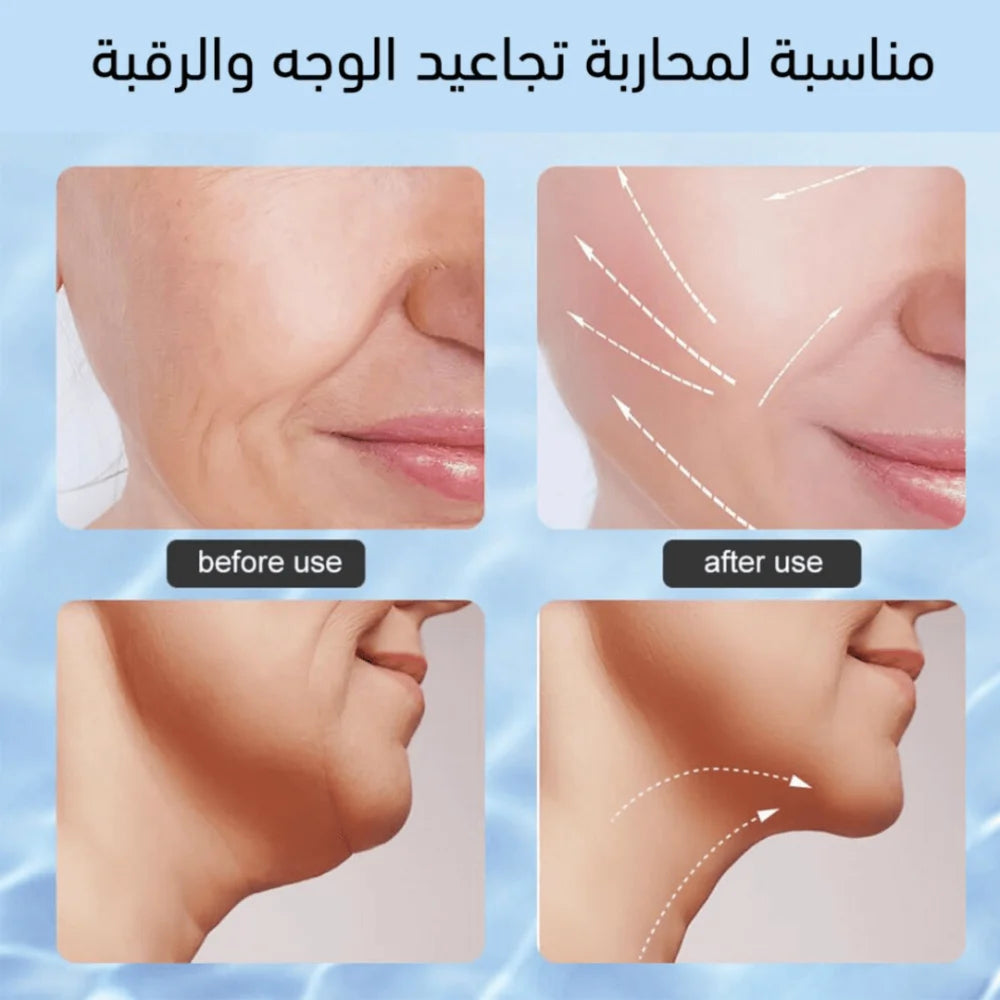 جهاز شد الوجه بالنبضات الدقيقة – لملامح أكثر شباباً